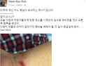 “미국서 작은 상처에도 치료비 590만원”…노환규 전 의협 회장 사연 공개