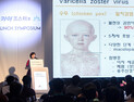 [의료산업 소식] SK케미칼 대상포진 백신 ‘스카이조스터’ 누적 매출 50억 달성 外