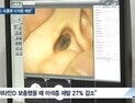 [쿠키건강뉴스] “부족한 비타민D 보충하면 이석증 예방 가능”
