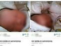 “36주 아이 팔아요” 경찰, 산모 찾았다… 아이 무사
