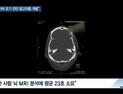 [쿠키건강뉴스] “알츠하이머병 조기 진단 ‘딥러닝 알고리즘’ 개발”