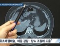 [쿠키건강뉴스] “1형 당뇨 고도비만 환자에 위소매절제술 효과적”