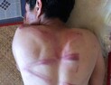 “구금 후 고문”·“구급대원 구타” 미얀마의 오늘, SNS는 알고 있다