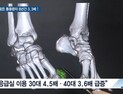 [쿠키건강뉴스] 통풍으로 응급실 찾은 환자 8년간 3.3배 증가