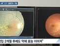 [쿠키건강뉴스] “주사효과 4배 지속” 황반변성 치료 ‘안구 임플란트’ 개발