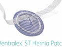 복부 탈장 치료 패치  ‘벤트랄렉스 에스티(Ventralex ST)’ 출시