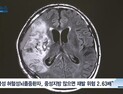 [쿠키건강뉴스] “중성지방 수치 높으면 급성 뇌졸중 재발 위험 커져”