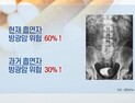 [쿠키건강뉴스] 흡연자 방광암 위험 60% 높아…“혈뇨 보이면 원인 검사”