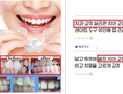“집에서 셀프 치아교정 가능”… 거짓 광고 적발