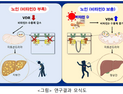 “노화로 인한 지방간, ‘이것’으로 예방”