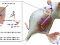화상으로 망가진 부위 