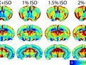 저산소증 활용한 MRI 뇌혈류 반복 촬영법 개발