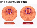 목소리 오남용 원인인 ‘이 병’ [건강 나침반] 