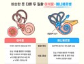 머리가 어질어질, 이유는 귀에 있다? [건강 나침반]