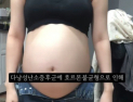 경찰, ‘36주 낙태’ 의료진 4명 추가 입건…살인방조 혐의