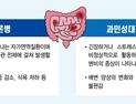 평생 동고동락 ‘크론병’, 증상 조절로 일상생활 가능 [건강 나침반]