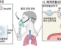 [쿠키과학] '폐질환 개선 26배 효과'… KAIST, 흡입용 mRNA 전달체 개발