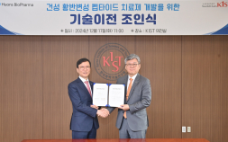 휴온스바이오파마, ‘건성 황반변성 점안제’ 개발 추진