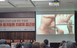 치료 사각지대 놓인 희귀질환 아이들…“치료제 접근성 강화 절실”