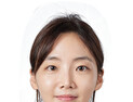 중앙대병원 박귀영 교수팀, CaHA 필러 ‘목주름·안면노화 개선’ 효과 규명
