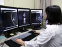 경상국립대병원, 인공지능(AI) 활용 '유방암 조기 진단 소프트웨어' 도입