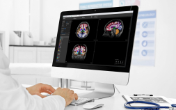건국대병원, ‘뉴로핏 아쿠아’ 도입…AI 분석 뇌 MRI 맞춤형 진료 본격화