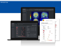 ‘주사 대신 AI’…건국대병원, 알츠하이머 진단 솔루션 BTX BRAIN 도입