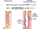 [쿠키과학] '혼자서도 잘 크는 위암'… IBS, 초기 위암세포 '자율성장 메커니즘' 규명