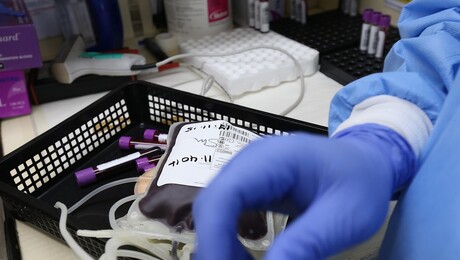 생계 위해 시험대 오르는 청년들…고액 임상시험 알바 이면 [쿠키청년기자단]