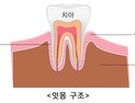 잇몸 통증 계속된다면? 복용약도 체크해야