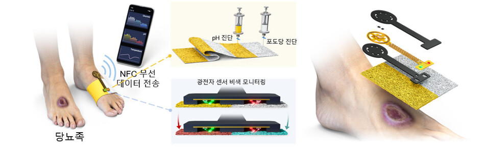 당뇨족 및 당뇨성 질환 진단을 위한 다중모달 비색 드레싱 및 광전자 센서의 개념도 . KAIST