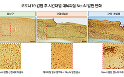 [쿠키과학] 코로나19 후유증 ‘브레인 포그’ 원인 찾았다… KIT-화학연, 뇌 오렉신 시스템 이상 규명