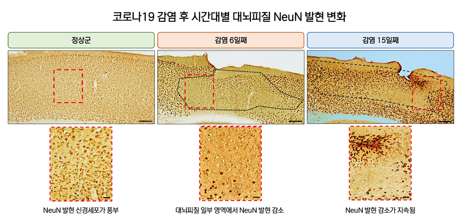 코로나19 감염 후 시간대별 대뇌피질 NeuN 발현 변화 추이. 국가독성과학연구소