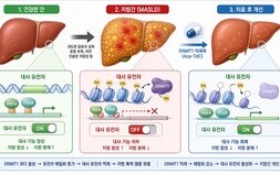 [쿠키과학] ‘유전자 스위치 되돌려 지방간 치료’… 생명연, 지방간 치료표적 ‘DNMT1’ 규명