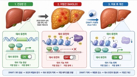 [쿠키과학] ‘유전자 스위치 되돌려 지방간 치료’… 생명연, 지방간 치료표적 ‘DNMT1’ 규명