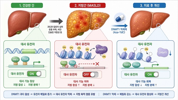 DNMT1 매개 DNA 메틸화에 의한 MASLD 진행 및 Aza-TdC의 치료 기전 모식도. 한국생명공학연구원